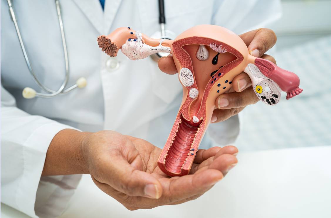 A medical professional demonstrating a uterus model for women's health education.