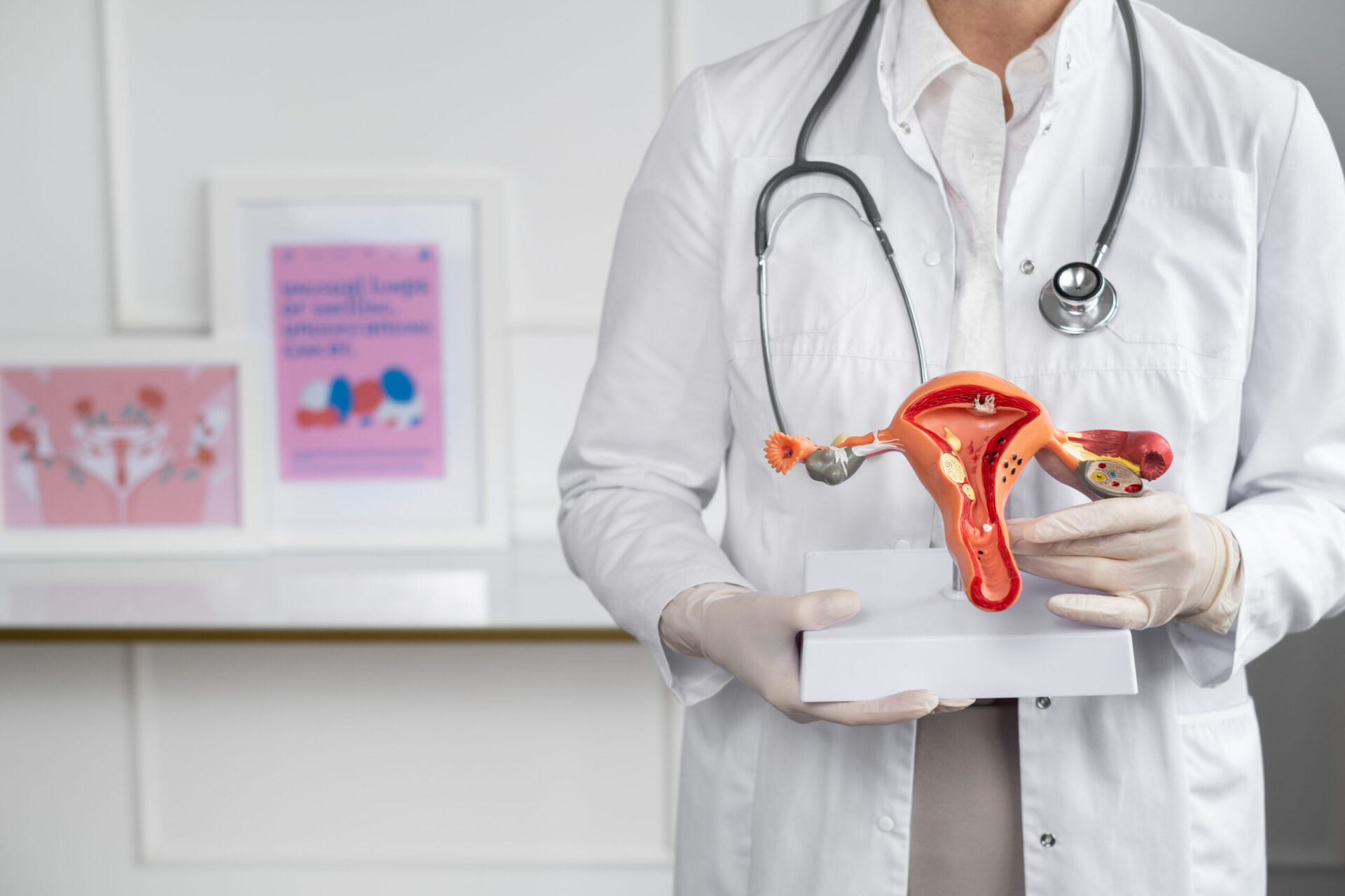 doctor holding an anatomical model of the uterus